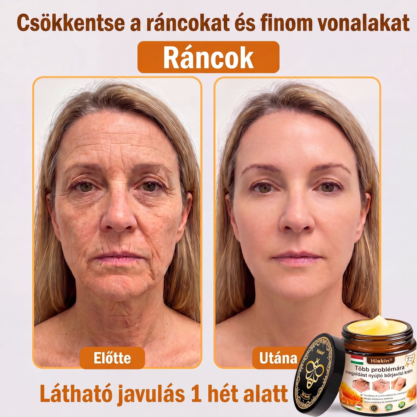 HISKIN® Többproblémás Bőrregeneráló Krém ✨ (Egyetlen hatékony krém a gyulladás, a szárazság, az öregedés jelei, a pigmentáció és a látható bőrkárosodás helyreállítására.)