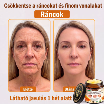 HISKIN® Többproblémás Bőrregeneráló Krém ✨ (Egyetlen hatékony krém a gyulladás, a szárazság, az öregedés jelei, a pigmentáció és a látható bőrkárosodás helyreállítására.)