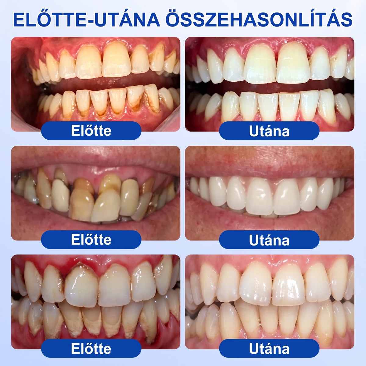 🇭🇺🏅🦷 HIVATALOS ÜZLET | Dr.Era® GumRevive Periodontal Repair Gel — Célzott fogínyápolás lepedék, fogszuvasodás, fogágyproblémák, kellemetlen lehelet és gyenge fogak esetén | Precíziós, leöblítést nem igénylő szájápoló formula