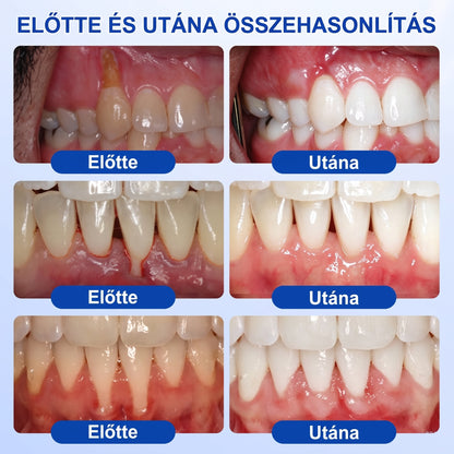 🇭🇺🏅🦷 HIVATALOS ÜZLET | Dr.Era® GumRevive Periodontal Repair Gel — Célzott fogínyápolás lepedék, fogszuvasodás, fogágyproblémák, kellemetlen lehelet és gyenge fogak esetén | Precíziós, leöblítést nem igénylő szájápoló formula