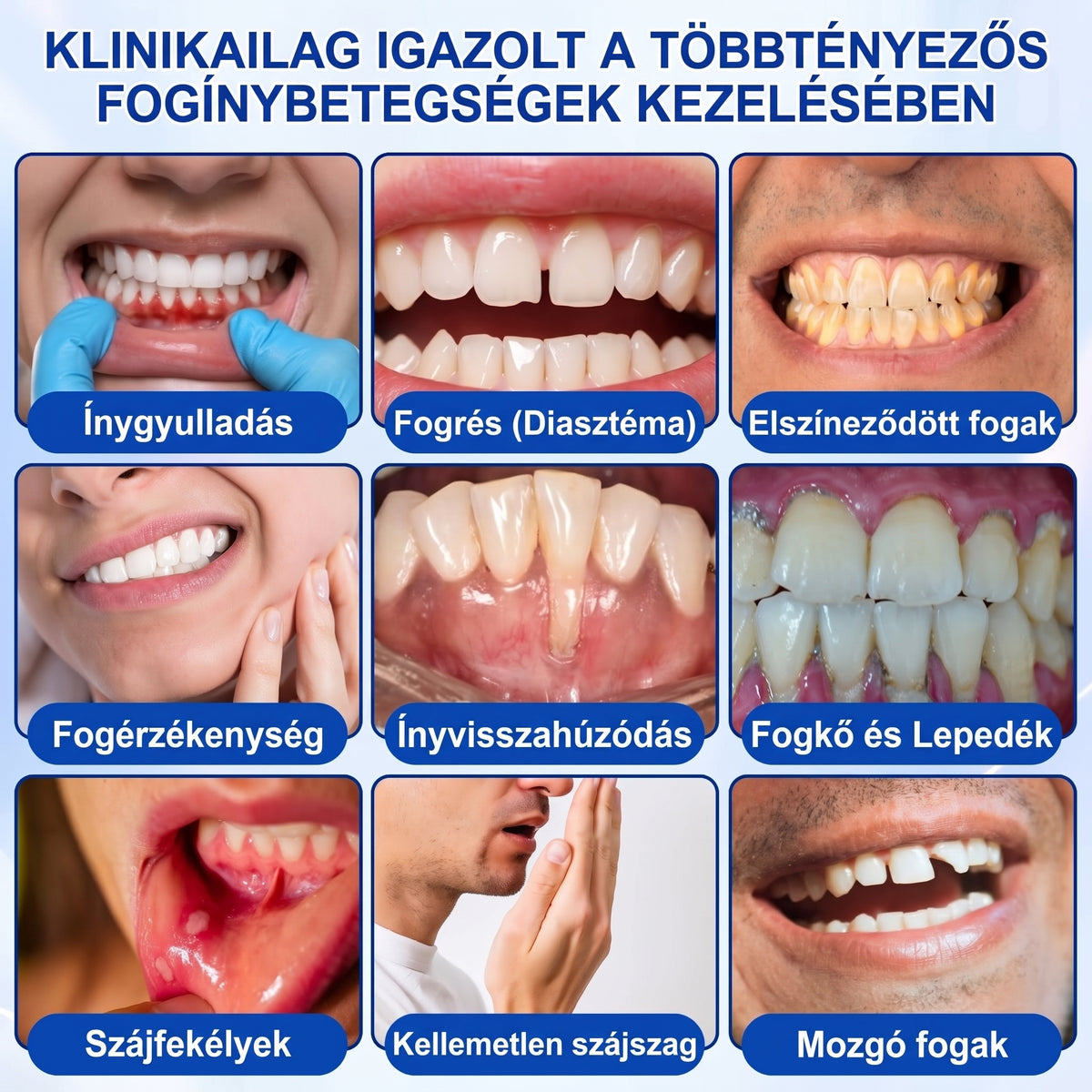 🇭🇺🏅🦷 HIVATALOS ÜZLET | Dr.Era® GumRevive Periodontal Repair Gel — Célzott fogínyápolás lepedék, fogszuvasodás, fogágyproblémák, kellemetlen lehelet és gyenge fogak esetén | Precíziós, leöblítést nem igénylő szájápoló formula