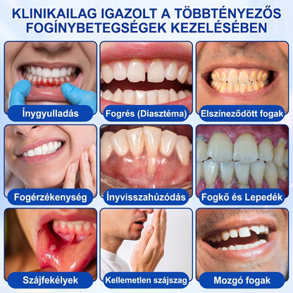 🇭🇺🏅🦷 HIVATALOS ÜZLET | Dr.Era® GumRevive Periodontal Repair Gel — Célzott fogínyápolás lepedék, fogszuvasodás, fogágyproblémák, kellemetlen lehelet és gyenge fogak esetén | Precíziós, leöblítést nem igénylő szájápoló formula