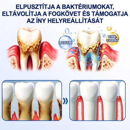 🇭🇺🏅🦷 HIVATALOS ÜZLET | Dr.Era® GumRevive Periodontal Repair Gel — Célzott fogínyápolás lepedék, fogszuvasodás, fogágyproblémák, kellemetlen lehelet és gyenge fogak esetén | Precíziós, leöblítést nem igénylő szájápoló formula