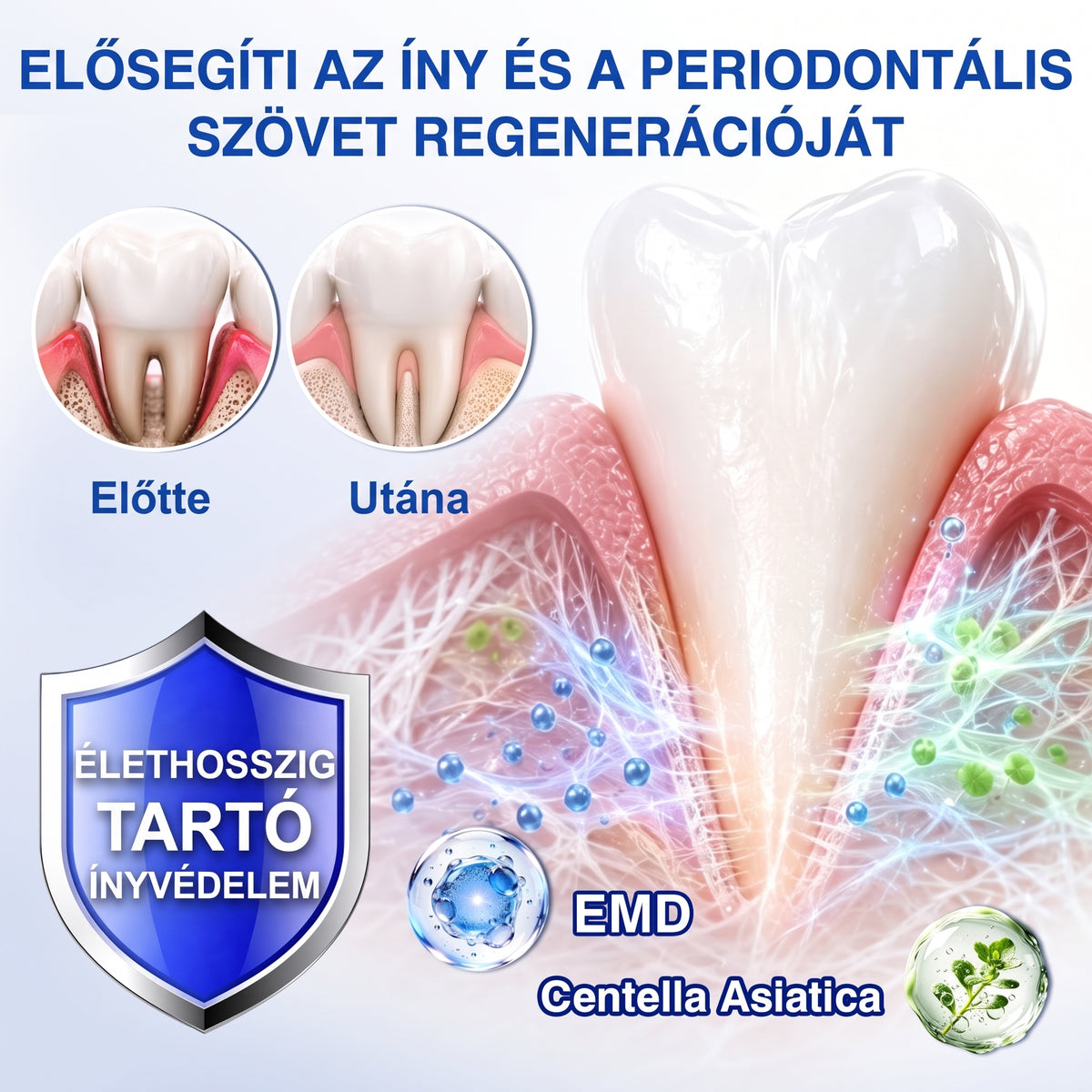 🇭🇺🏅🦷 HIVATALOS ÜZLET | Dr.Era® GumRevive Periodontal Repair Gel — Célzott fogínyápolás lepedék, fogszuvasodás, fogágyproblémák, kellemetlen lehelet és gyenge fogak esetén | Precíziós, leöblítést nem igénylő szájápoló formula