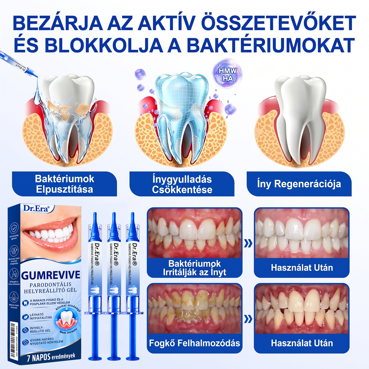 🇭🇺🏅🦷 HIVATALOS ÜZLET | Dr.Era® GumRevive Periodontal Repair Gel — Célzott fogínyápolás lepedék, fogszuvasodás, fogágyproblémák, kellemetlen lehelet és gyenge fogak esetén | Precíziós, leöblítést nem igénylő szájápoló formula