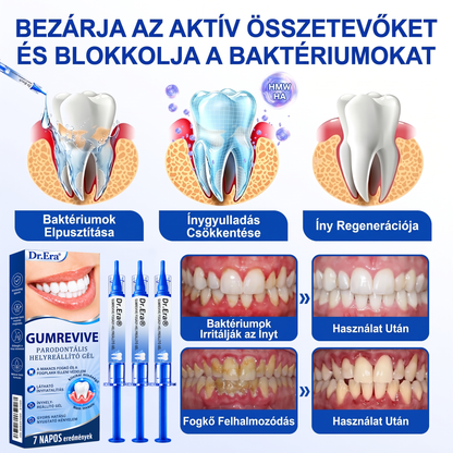 🇭🇺🏅🦷 HIVATALOS ÜZLET | Dr.Era® GumRevive Periodontal Repair Gel — Célzott fogínyápolás lepedék, fogszuvasodás, fogágyproblémák, kellemetlen lehelet és gyenge fogak esetén | Precíziós, leöblítést nem igénylő szájápoló formula