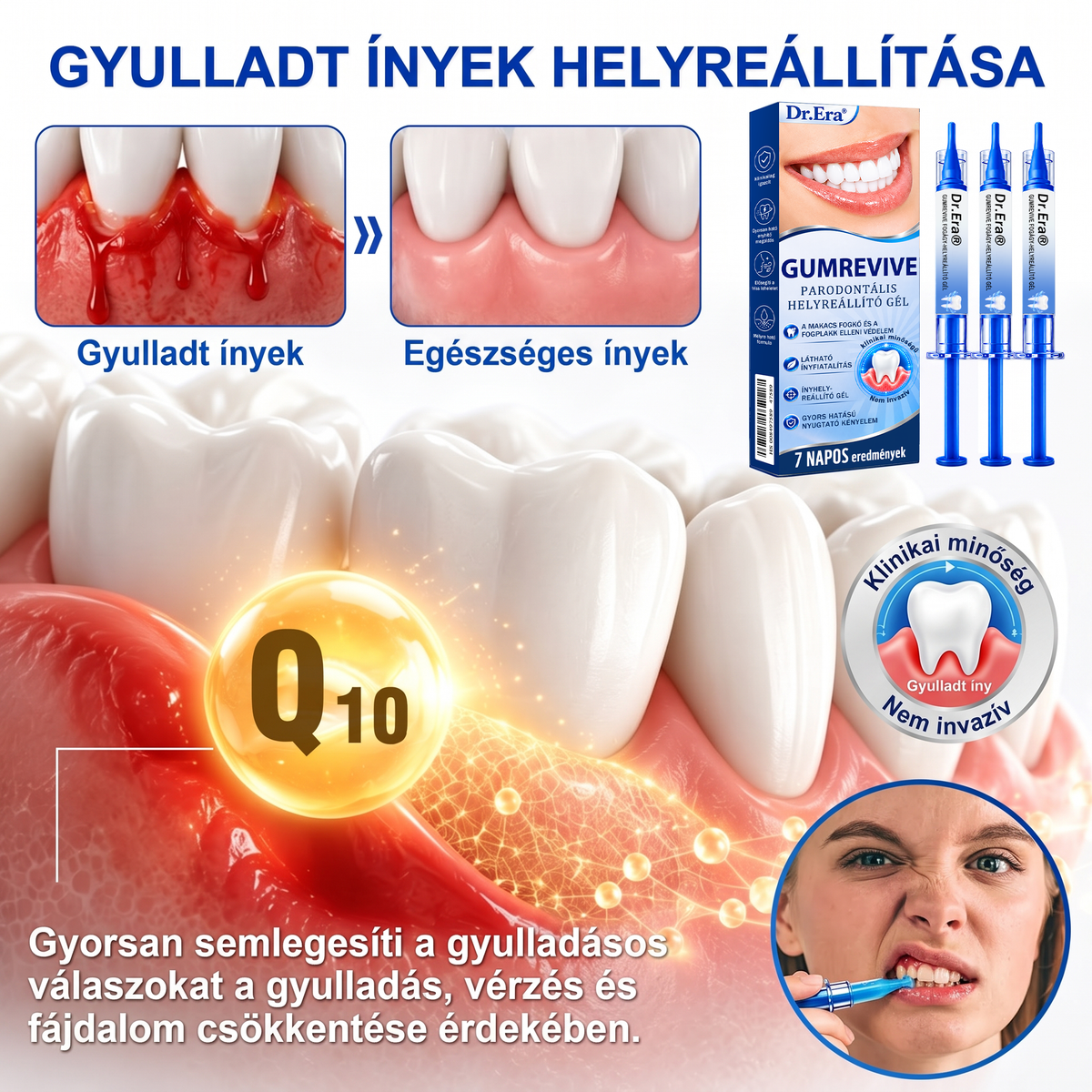 🇭🇺🏅🦷 HIVATALOS ÜZLET | Dr.Era® GumRevive Periodontal Repair Gel — Célzott fogínyápolás lepedék, fogszuvasodás, fogágyproblémák, kellemetlen lehelet és gyenge fogak esetén | Precíziós, leöblítést nem igénylő szájápoló formula