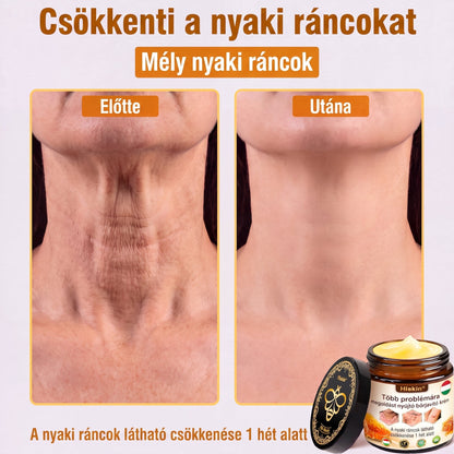 HISKIN® Többproblémás Bőrregeneráló Krém ✨ (Egyetlen hatékony krém a gyulladás, a szárazság, az öregedés jelei, a pigmentáció és a látható bőrkárosodás helyreállítására.)