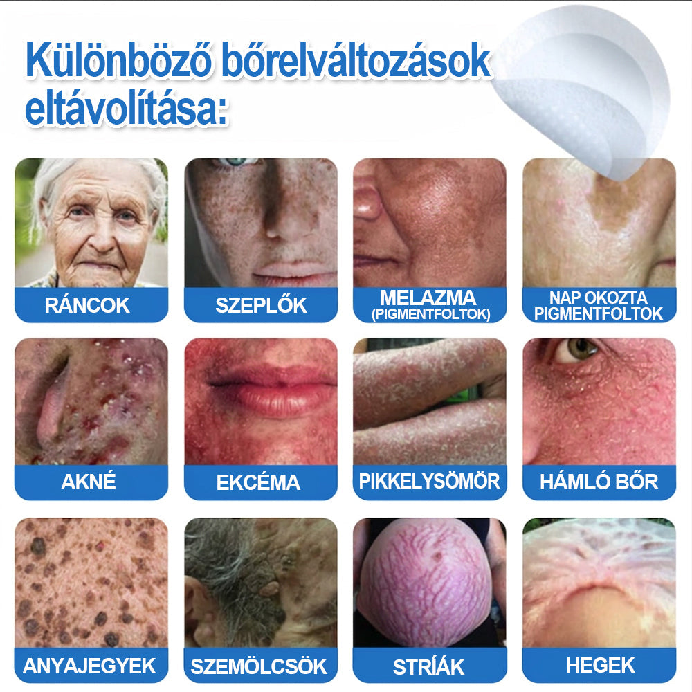 👩‍⚕️ 𝐇𝐢𝐬𝐤𝐢𝐧® 𝟐 𝐚𝐳 𝟏-𝐛𝐞𝐧 𝐌𝐢𝐤𝐫𝐨𝐭ű𝐬 & 𝐇𝐢𝐝𝐫𝐨𝐤𝐨𝐥𝐥𝐨𝐢𝐝 𝐓𝐚𝐩𝐚𝐬𝐳 | 𝐊𝐢𝐞𝐦𝐞𝐥𝐤𝐞𝐝ő 𝐚𝐧𝐲𝐚𝐣𝐞𝐠𝐲𝐞𝐤, 𝐚𝐤𝐧é, 𝐥𝐚𝐩𝐨𝐬 𝐬𝐳𝐞𝐦ö𝐥𝐜𝐬ö𝐤 é𝐬 𝐛ő𝐫𝐤𝐢𝐧ö𝐯é𝐬𝐞𝐤 𝐞𝐥𝐭á𝐯𝐨𝐥í𝐭á𝐬á𝐫𝐚 | 𝐒𝐞𝐠í𝐭 𝐣𝐚𝐯í𝐭𝐚𝐧𝐢 𝐚 𝐫á𝐧𝐜𝐨𝐤, 𝐡𝐞𝐠𝐞𝐤 é𝐬 𝐛ő𝐫𝐡𝐢𝐛á𝐤 𝐦𝐞𝐠𝐣𝐞𝐥𝐞𝐧é𝐬é𝐭 | 𝐋á𝐭𝐡𝐚𝐭𝐚𝐭𝐥𝐚𝐧 𝐜𝐬𝐢𝐥𝐥𝐚𝐠 𝐚𝐥𝐚𝐤ú 𝐩𝐚𝐭𝐭𝐚𝐧á𝐬𝐭𝐚𝐩𝐚𝐬𝐳 𝐚𝐫𝐜𝐫𝐚 é𝐬 𝐭𝐞𝐬𝐭𝐫𝐞
