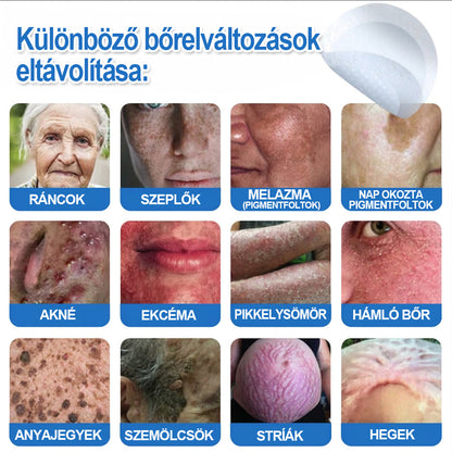 👩‍⚕️ 𝐇𝐢𝐬𝐤𝐢𝐧® 𝟐 𝐚𝐳 𝟏-𝐛𝐞𝐧 𝐌𝐢𝐤𝐫𝐨𝐭ű𝐬 & 𝐇𝐢𝐝𝐫𝐨𝐤𝐨𝐥𝐥𝐨𝐢𝐝 𝐓𝐚𝐩𝐚𝐬𝐳 | 𝐊𝐢𝐞𝐦𝐞𝐥𝐤𝐞𝐝ő 𝐚𝐧𝐲𝐚𝐣𝐞𝐠𝐲𝐞𝐤, 𝐚𝐤𝐧é, 𝐥𝐚𝐩𝐨𝐬 𝐬𝐳𝐞𝐦ö𝐥𝐜𝐬ö𝐤 é𝐬 𝐛ő𝐫𝐤𝐢𝐧ö𝐯é𝐬𝐞𝐤 𝐞𝐥𝐭á𝐯𝐨𝐥í𝐭á𝐬á𝐫𝐚 | 𝐒𝐞𝐠í𝐭 𝐣𝐚𝐯í𝐭𝐚𝐧𝐢 𝐚 𝐫á𝐧𝐜𝐨𝐤, 𝐡𝐞𝐠𝐞𝐤 é𝐬 𝐛ő𝐫𝐡𝐢𝐛á𝐤 𝐦𝐞𝐠𝐣𝐞𝐥𝐞𝐧é𝐬é𝐭 | 𝐋á𝐭𝐡𝐚𝐭𝐚𝐭𝐥𝐚𝐧 𝐜𝐬𝐢𝐥𝐥𝐚𝐠 𝐚𝐥𝐚𝐤ú 𝐩𝐚𝐭𝐭𝐚𝐧á𝐬𝐭𝐚𝐩𝐚𝐬𝐳 𝐚𝐫𝐜𝐫𝐚 é𝐬 𝐭𝐞𝐬𝐭𝐫𝐞