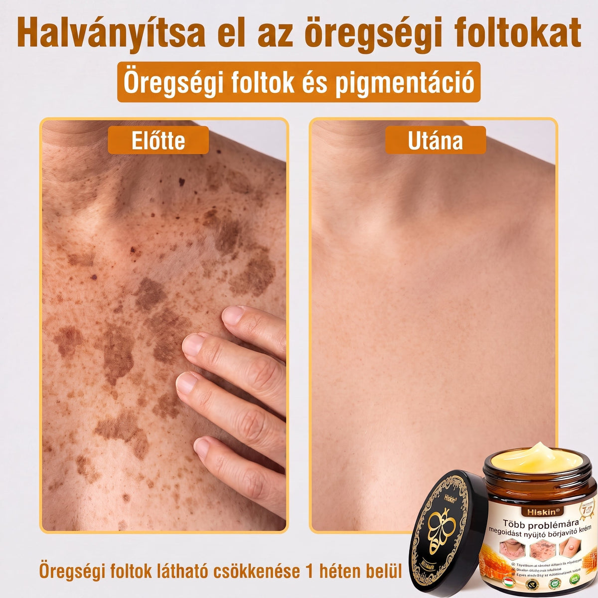 HISKIN® Többproblémás Bőrregeneráló Krém ✨ (Egyetlen hatékony krém a gyulladás, a szárazság, az öregedés jelei, a pigmentáció és a látható bőrkárosodás helyreállítására.)