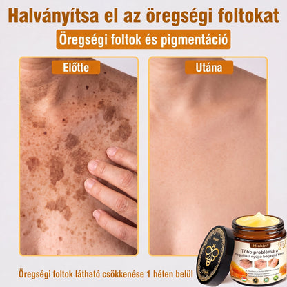 HISKIN® Többproblémás Bőrregeneráló Krém ✨ (Egyetlen hatékony krém a gyulladás, a szárazság, az öregedés jelei, a pigmentáció és a látható bőrkárosodás helyreállítására.)