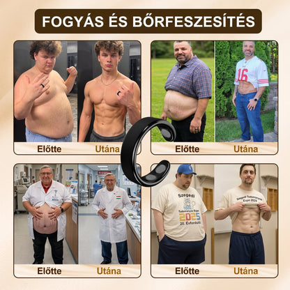 Resupe® Fogyókúrás Anyagcsere Mágneses Terápiás Gyűrű: Hárommagos Anyagcsere Aktiválás — Mindössze 30 perc naponta a Fogyás és a Nyirokkeringés támogatására — Plusz ízületi enyhülés, jobb alvás és mentális tisztaság.