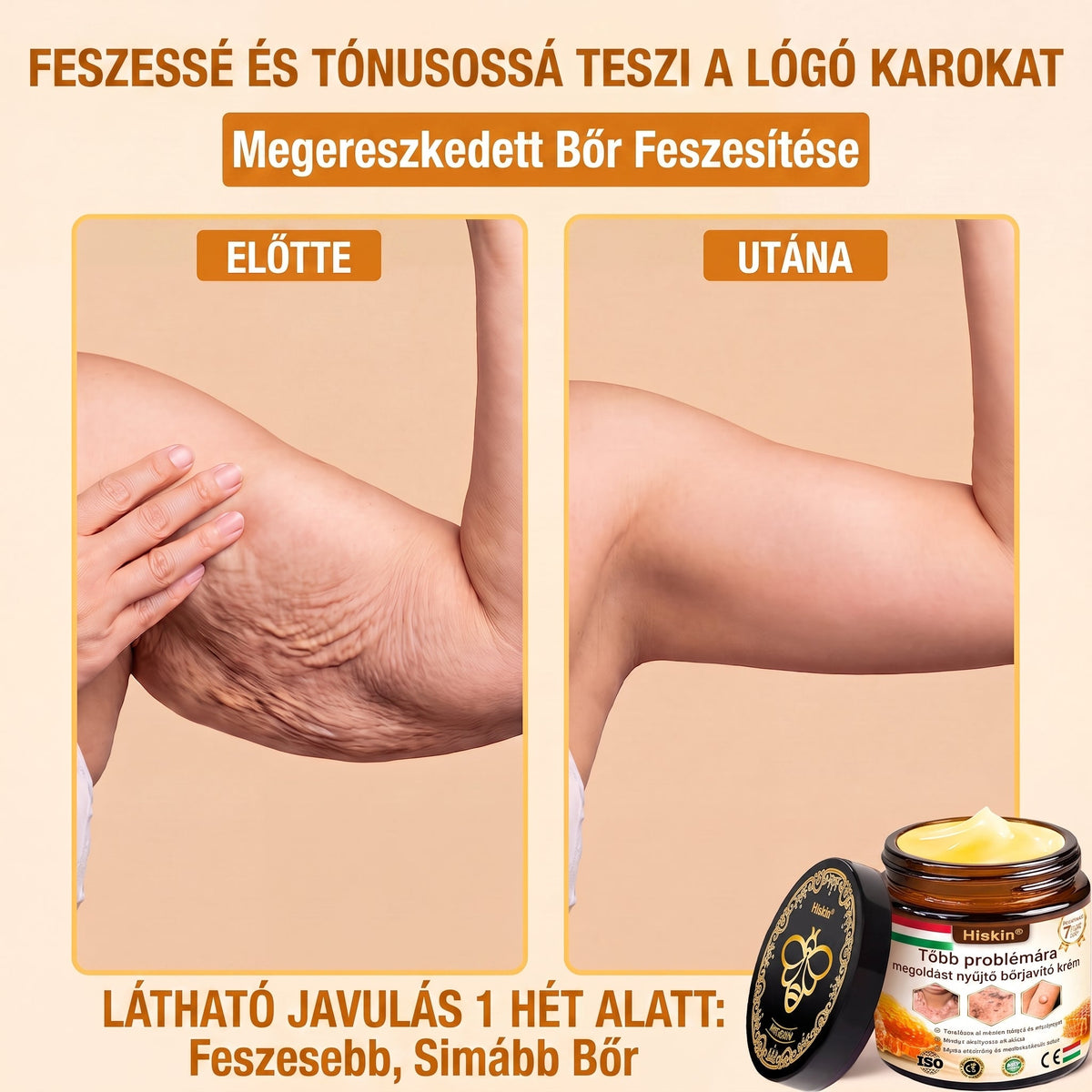 HISKIN® Többproblémás Bőrregeneráló Krém ✨ (Egyetlen hatékony krém a gyulladás, a szárazság, az öregedés jelei, a pigmentáció és a látható bőrkárosodás helyreállítására.)