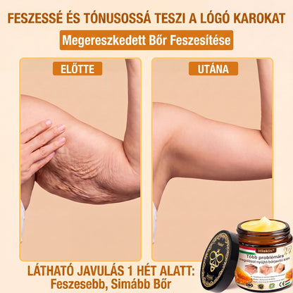 HISKIN® Többproblémás Bőrregeneráló Krém ✨ (Egyetlen hatékony krém a gyulladás, a szárazság, az öregedés jelei, a pigmentáció és a látható bőrkárosodás helyreállítására.)