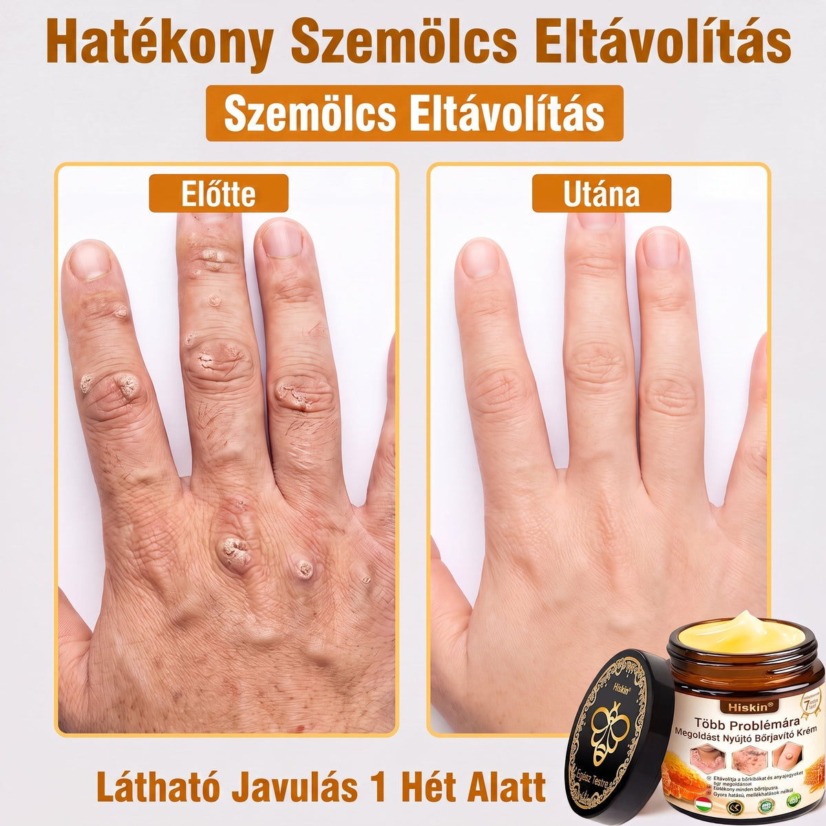 HISKIN® Többproblémás Bőrregeneráló Krém ✨ (Egyetlen hatékony krém a gyulladás, a szárazság, az öregedés jelei, a pigmentáció és a látható bőrkárosodás helyreállítására.)