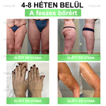 🔥 Exkluzív vásárlói ajánlat — egészítsd ki rendelésed még több GENAYU® termékkel most 50% KEDVEZMÉNNYEL! Már elkezdted a rutinodat — töltsd fel most a készleteidet ezen az egyszeri, kizárólag meglévő vásárlóknak szóló különleges áron.