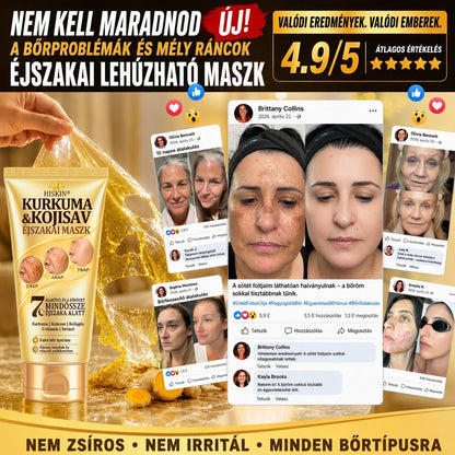 💟𝑯𝒊𝒗𝒂𝒕𝒂𝒍𝒐𝒔 𝑼̈𝒛𝒍𝒆𝒕 | 𝐔́𝐣! ✨ 𝐇𝐢𝐬𝐤𝐢𝐧® 𝐊𝐮𝐫𝐤𝐮𝐦𝐚 × 𝐊𝐨𝐣𝐢𝐧𝐬𝐚𝐯 𝐄́𝐣𝐬𝐳𝐚𝐤𝐚𝐢 𝐋𝐞𝐡𝐮́𝐳𝐡𝐚𝐭𝐨́ 𝐌𝐚𝐬𝐳𝐤 — 𝐇𝐚𝐥𝐯𝐚́𝐧𝐲𝐢́𝐭𝐬𝐝 𝐚 𝐦𝐚𝐤𝐚𝐜𝐬 𝐬𝐨̈𝐭𝐞́𝐭 𝐟𝐨𝐥𝐭𝐨𝐤𝐚𝐭 𝐞́𝐬 𝐬𝐢𝐦𝐢́𝐭𝐬𝐝 𝐤𝐢 𝐚 𝐥𝐚́𝐭𝐡𝐚𝐭𝐨́ 𝐫𝐚́𝐧𝐜𝐨𝐤𝐚𝐭 𝐚𝐥𝐯𝐚́𝐬 𝐤𝐨̈𝐳𝐛𝐞𝐧 𝐄́𝐣𝐬𝐳𝐚𝐤𝐚́𝐧𝐤𝐞́𝐧𝐭 𝐞𝐠𝐲 𝐥𝐞́𝐩𝐞́𝐬 · 𝐋𝐚́𝐭𝐡𝐚𝐭𝐨́ 𝐯𝐚́𝐥𝐭𝐨𝐳𝐚́𝐬 𝟕 𝐞́𝐣𝐬𝐳𝐚𝐤𝐚 𝐚𝐥𝐚𝐭𝐭✨✨