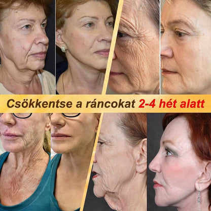 HISKIN® Többproblémás Bőrregeneráló Krém ✨ (Egyetlen hatékony krém a gyulladás, a szárazság, az öregedés jelei, a pigmentáció és a látható bőrkárosodás helyreállítására.)