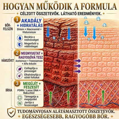 HISKIN® Többproblémás Bőrregeneráló Krém ✨ (Egyetlen hatékony krém a gyulladás, a szárazság, az öregedés jelei, a pigmentáció és a látható bőrkárosodás helyreállítására.)